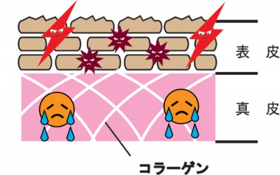 紫外線は身体に悪いもの?